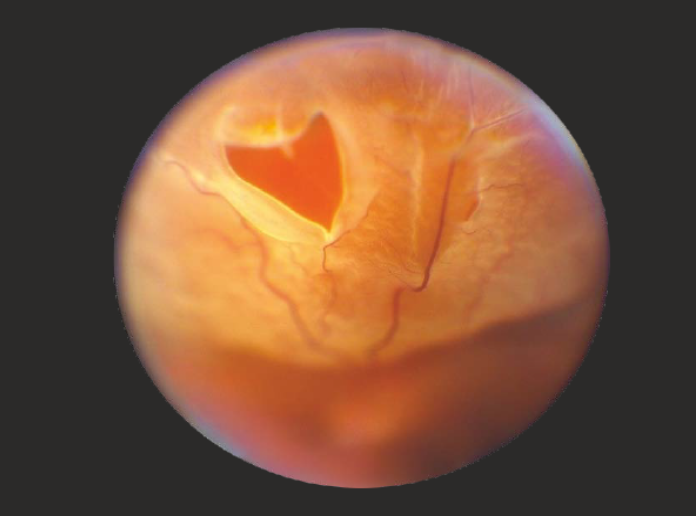 Επιλέχθηκε εικόνα